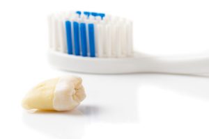 52485257 - extractred tooth and toothbrush